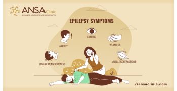 Epilepsy Symptoms